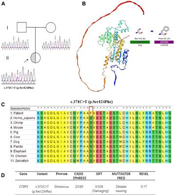 A novel CTBP1 variant in a Chinese pediatric patient with a phenotype distinct from hypotonia, ataxia, developmental delay, and tooth enamel defect syndrome